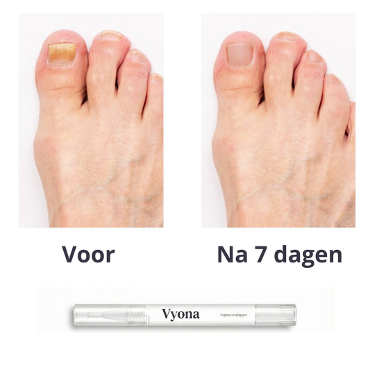 Nagelverzorgingspen