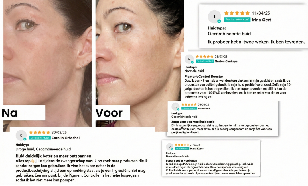 Booster tegen pigmentvlekken