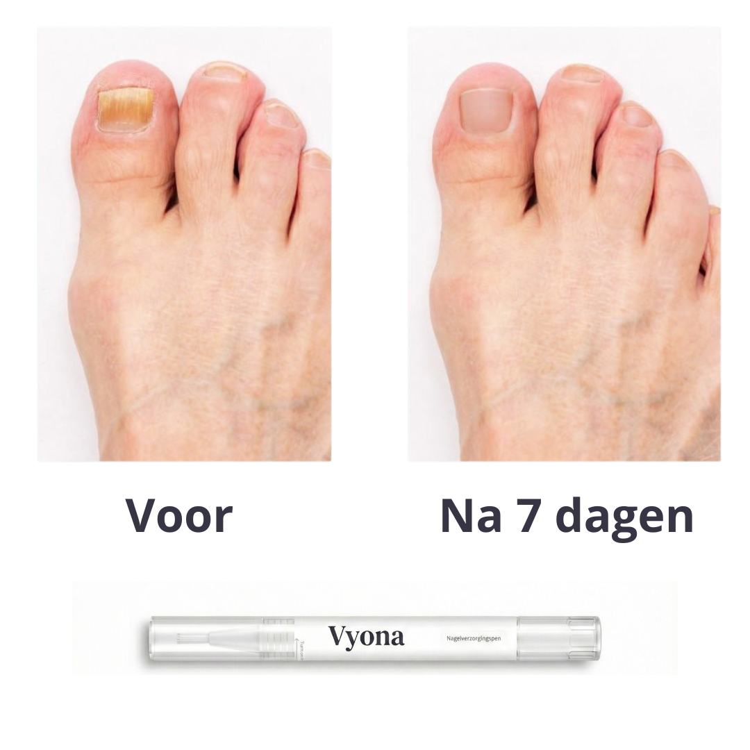 Nagelverzorgingspen