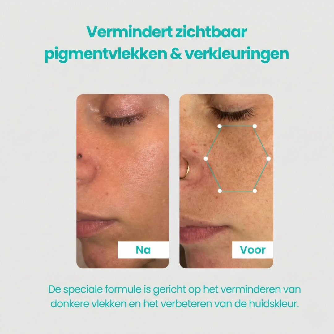Booster tegen pigmentvlekken