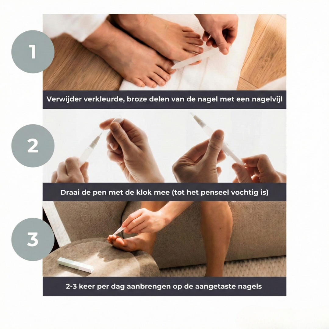 Nagelverzorgingspen